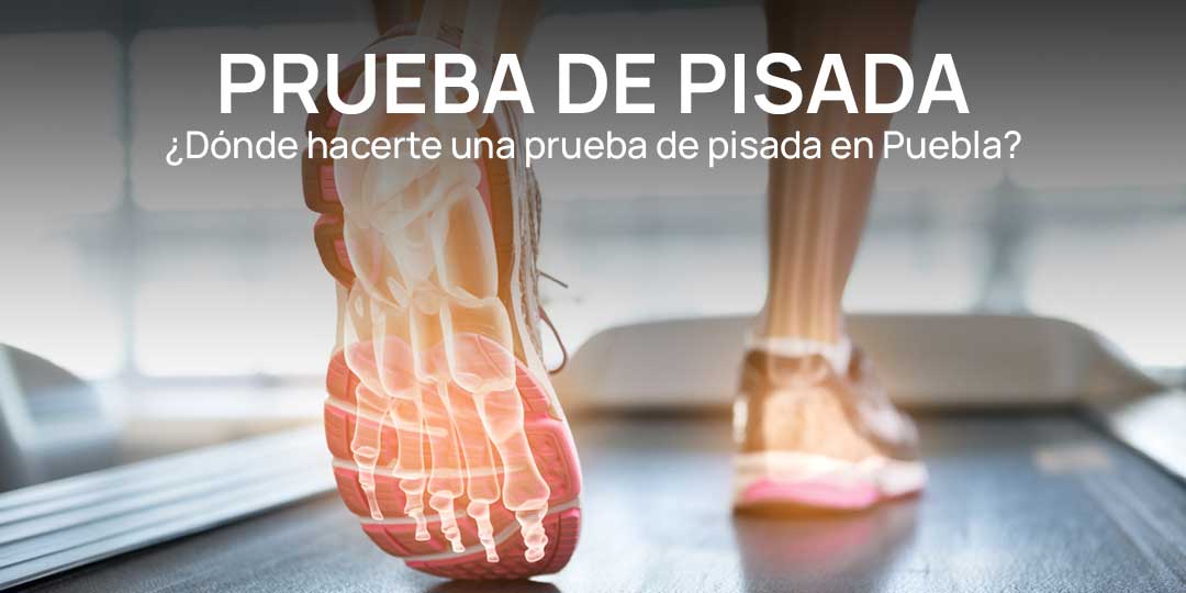 ¿Dónde hacerte una prueba de pisada en Puebla y por qué es importante?